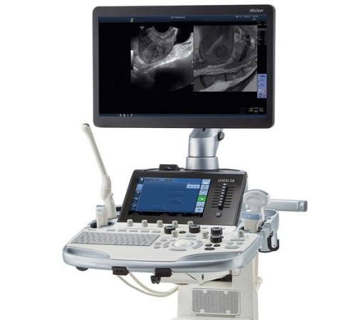 GE Healthcare Logiq S8